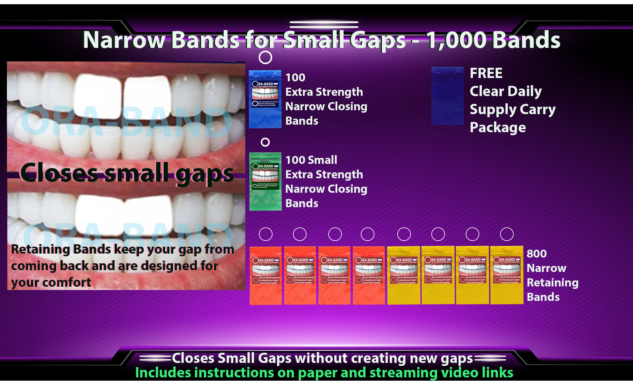 ORA-BAND 1,000 Band Narrow Bands Package for 
Small Gaps between your 2 front teeth
