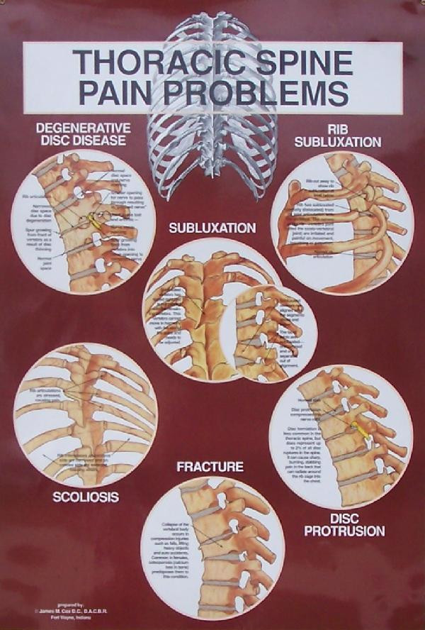 Thoracic Spine Diagnosis Anatomical Chart