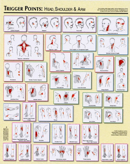 travell and simons trigger point charts