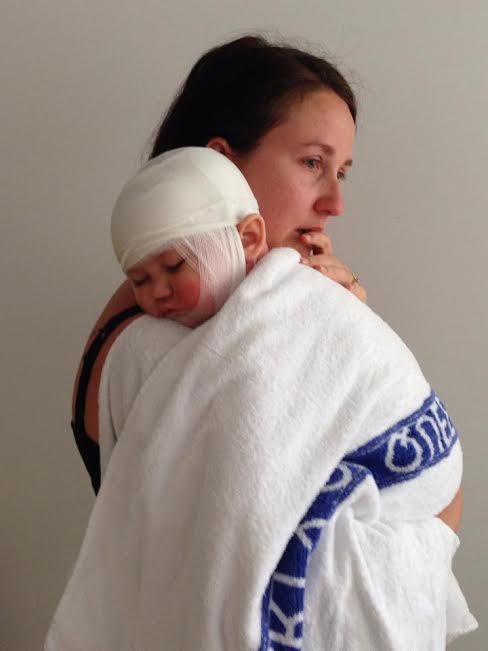 wet wrapping for eczema | Mumsnet Discussion