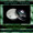 Aventurine ~ Crystal Meaning: Wealth/Good Luck/Abundance/Creativity/Calmness/Balance/Confidence

Aventurine Scent: Patchouli, Orange, Eucalyptus, YlangYlang (matches Spring Spa Soap) 