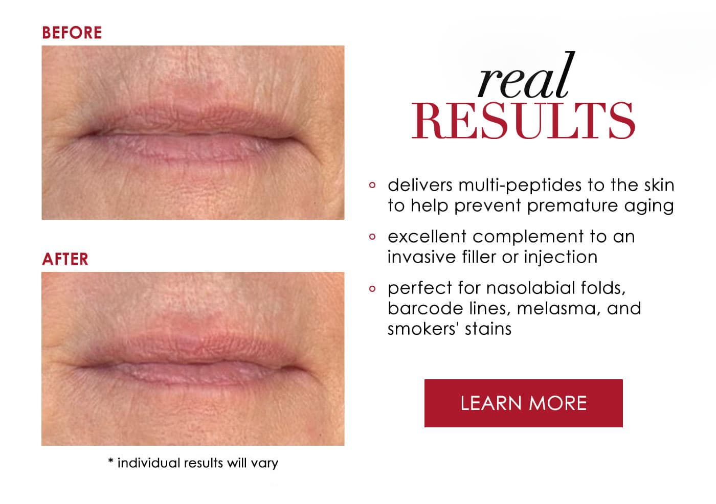 Real Results