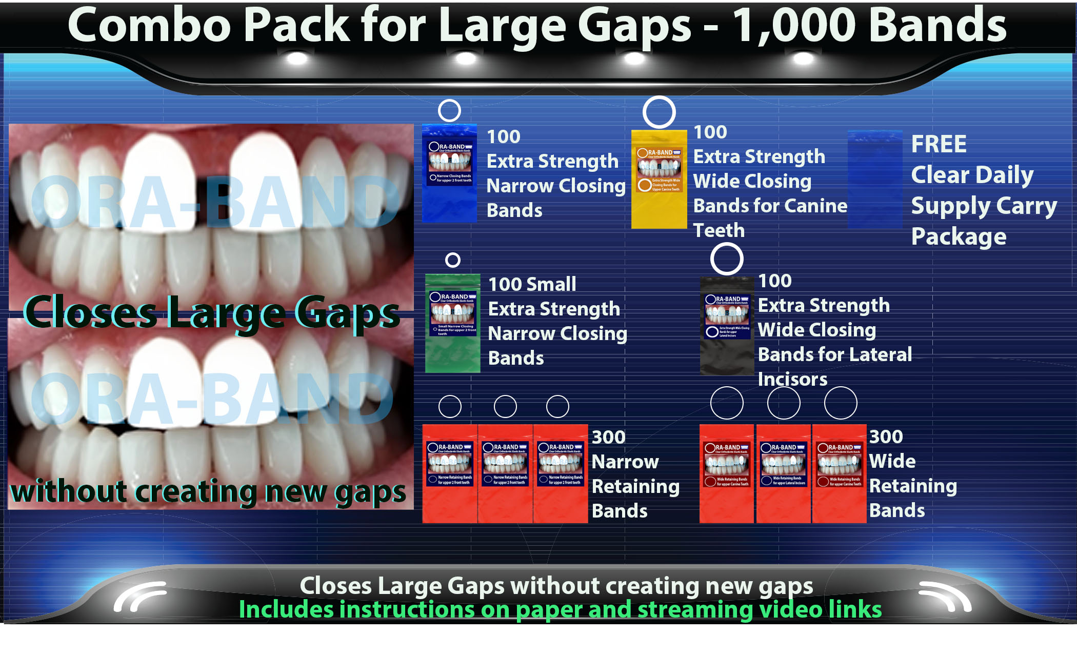 ORA-BAND 1,000 Band Combo Pack for 
Large Gaps between your 2 front teeth