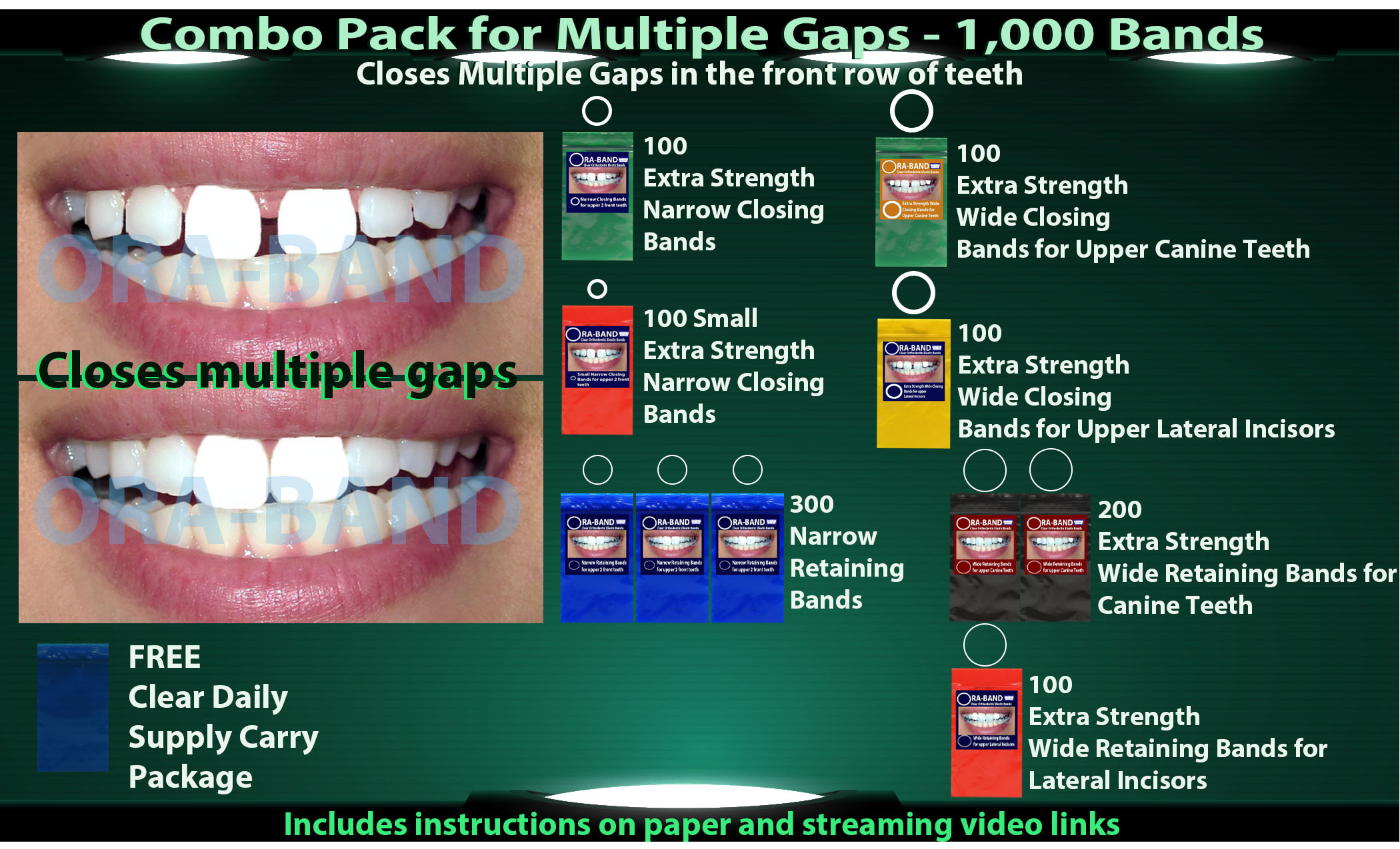 ORA-BAND 1,000 Band Combo Pack for Multiple Gaps in your front row of teeth