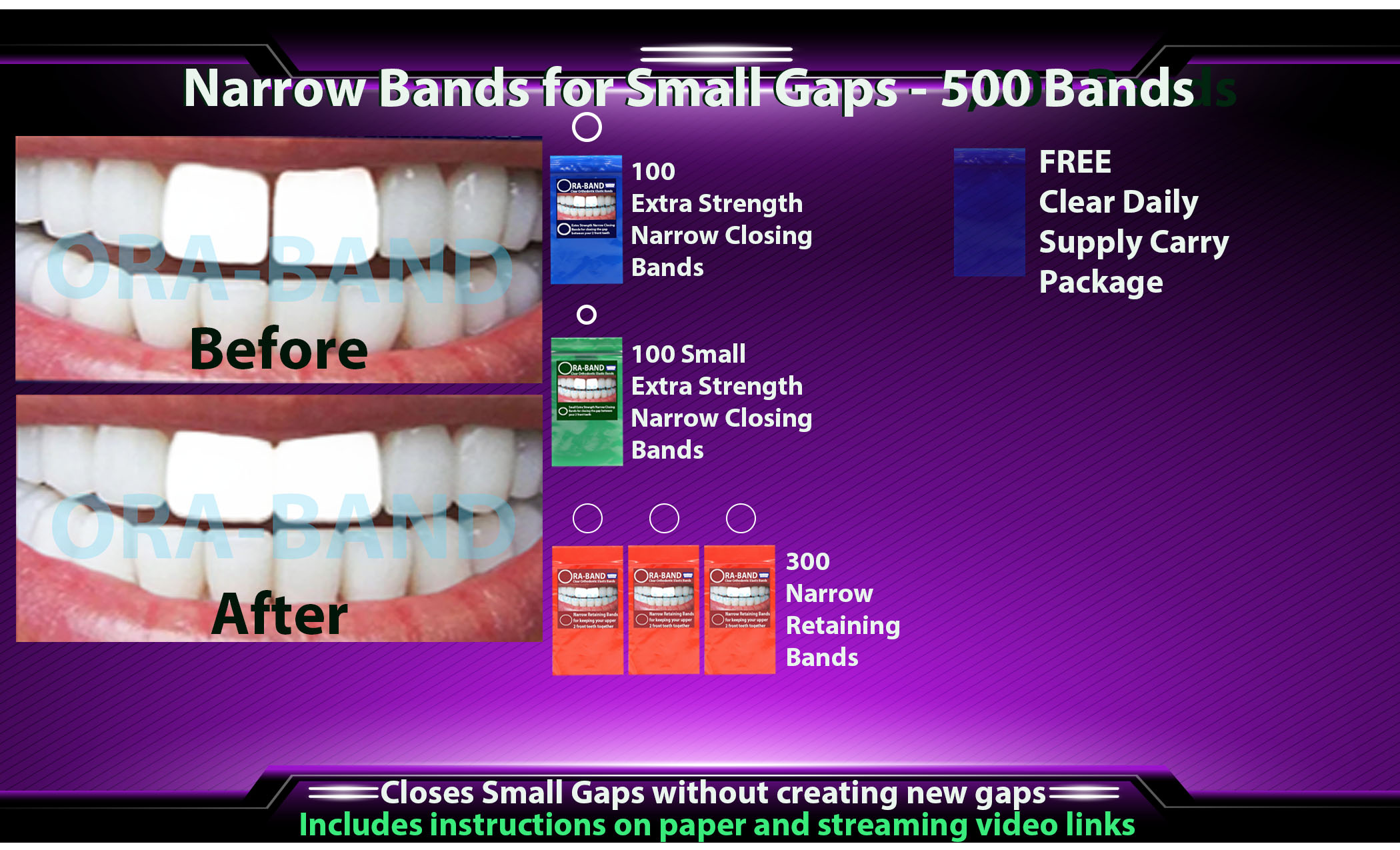 ORA-BAND 500 Band Narrow Bands Package for 
Small Gaps between your 2 front teeth