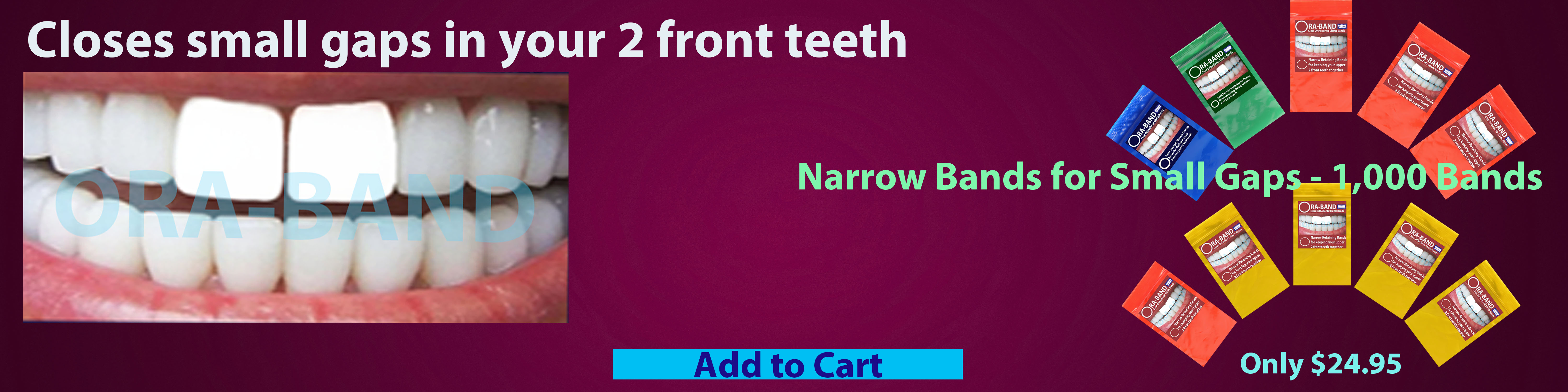 ORA-BAND 1,000 Band Narrow Bands Package for 
Small Gaps between your 2 front teeth