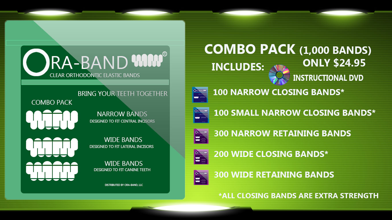 Combo Pack - 1,000 BANDS *Includes 200 Extra Strength Narrow Closing Bands, 300 Narrow Retaining Bands, 200 Extra Strength Wide Bands and 300 Wide Retaining Bands