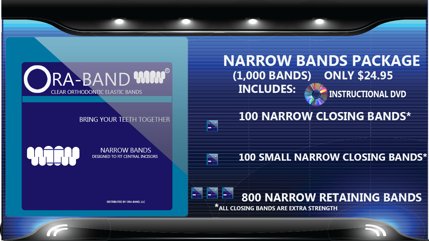 1,000 Narrow Bands *Includes 200 Extra Strength Narrow Closing Bands and 800 Narrow Retaining Bands