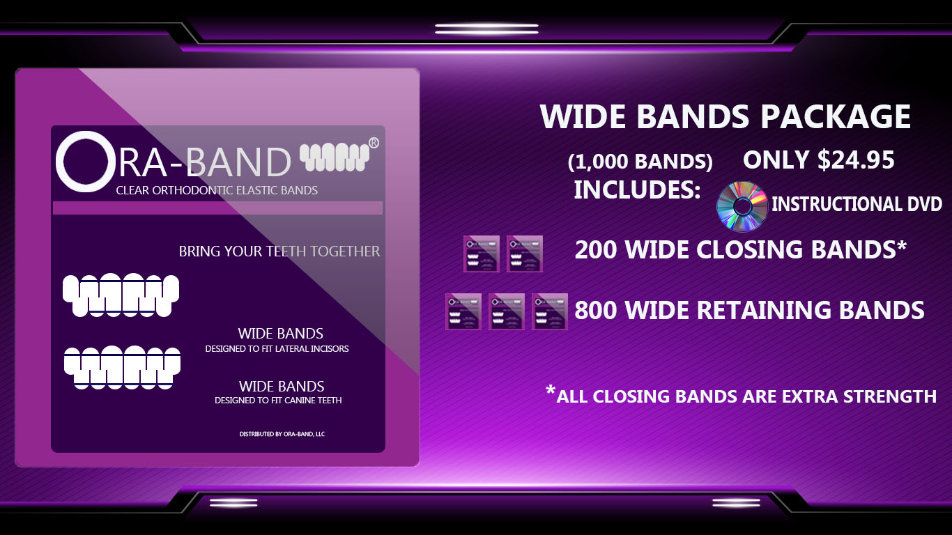 1,000 Wide Bands (Includes 200 Extra Strength Wide Closing Bands and 800 Wide Retaining Bands)