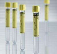 16x100 VACUETTE® Urine Tube, Conical Bottom, 9.5 ml Draw, Yellow Pull Closure with Yellow Ring SKU: 224-260-1100