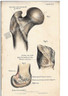 Plate 63 'Gluteous medius, Obturator internus Gemille Pyriformis, External condyle..' Antique Lithograph c.1855