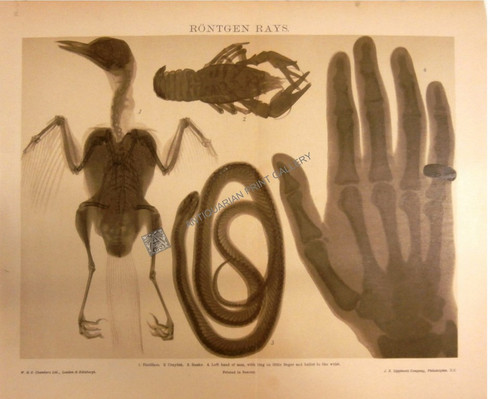 Medical Disease X-ray Röntgen Rays Antique print. German Physicist Wilhelm Conrad Röntgen became the father of diagnostic Radiology in 1896. Diagnostic Tool for identifying disease & internal injury.