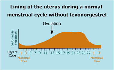 hcw-lining-of-uterus-no-hc380.jpg