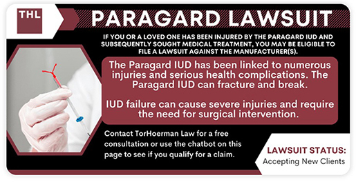 paragard-lawsuit-515.jpg