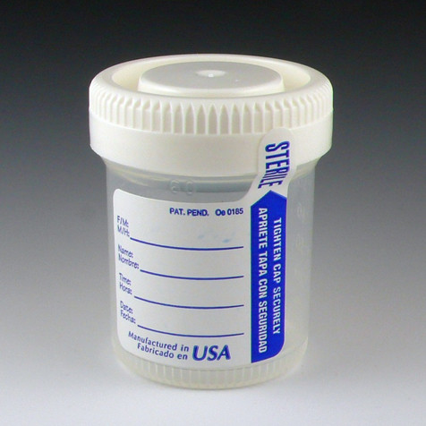 5oz Graduated Urine Collection Container with Snap Cap Non-Sterile Globe  5917