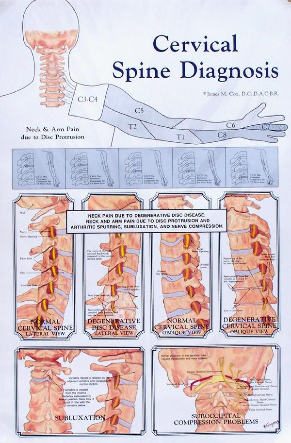 Cervical Spine Diagnosis Anatomy Poster - Clinical Charts and Supplies