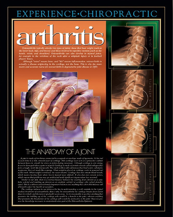 Arthritis Chiropractic Poster Clinical Charts and Supplies