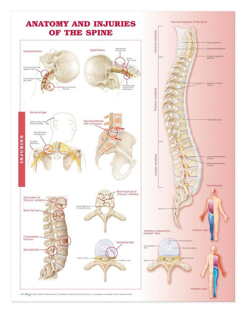 Vertebral Spine Injuries Poster Clinical Charts And Supplies 2158