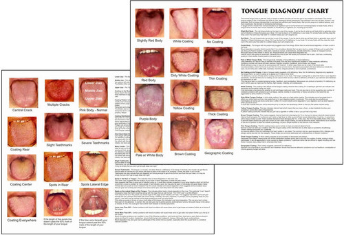 Tongue Diagnosis Chart - Clinical Charts and Supplies