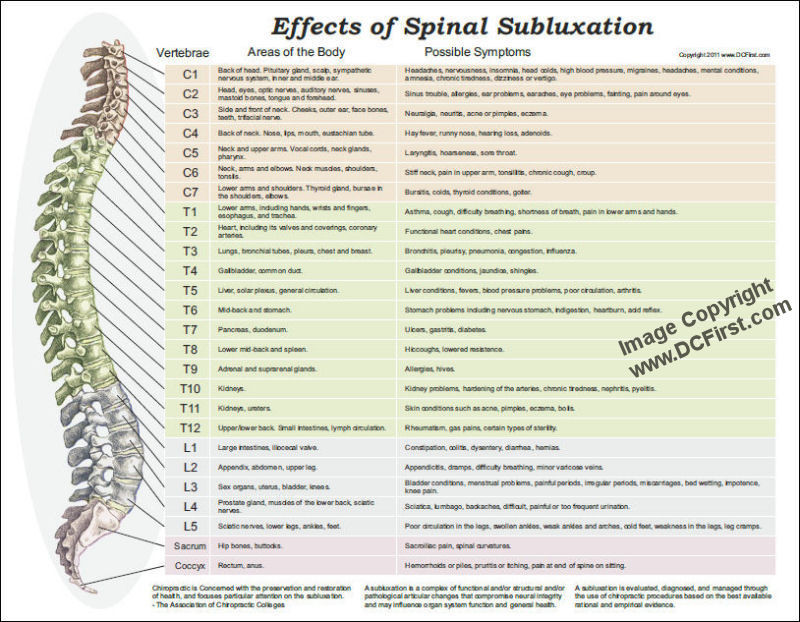 Effects of Spinal Subluxation Poster - Clinical Charts and Supplies