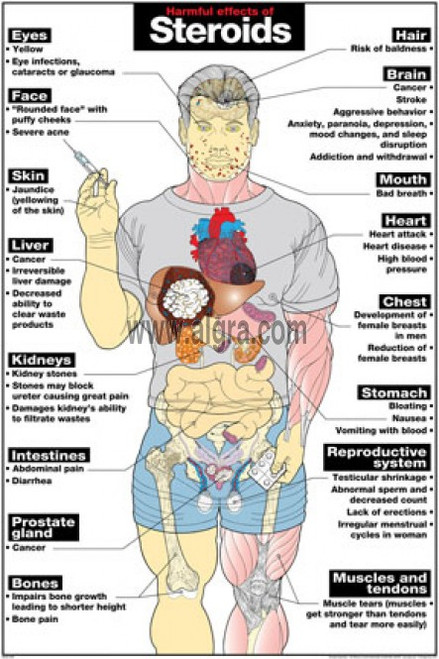 Effects Of Steroids Poster - Clinical Charts And Supplies