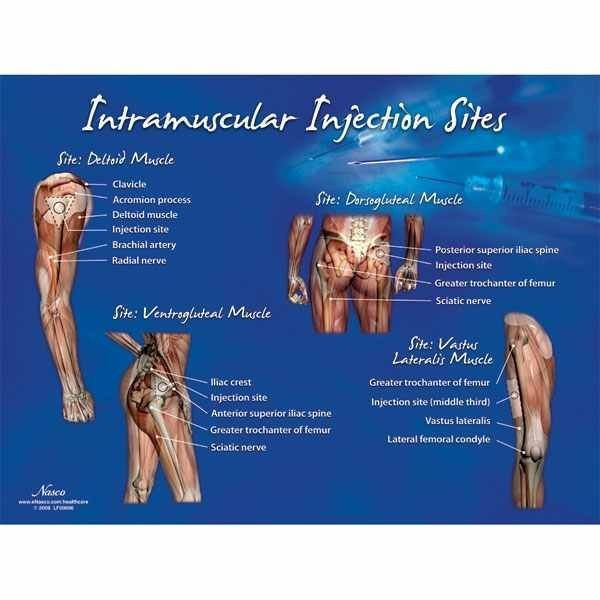 intramuscular-injection-sites-clinical-charts-and-supplies