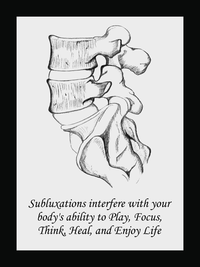 Subluxation And Chiropractic Poster Clinical Charts And Supplies 5053