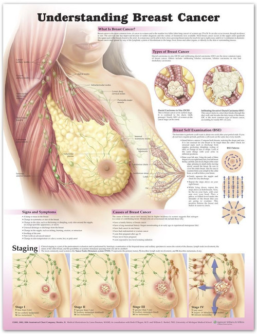 breast cancer chart understanding poster anatomy anatomical lymph 3rd nodes female veins edition ed diagram human types charts clinical medical