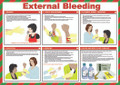 External Bleeding Poster